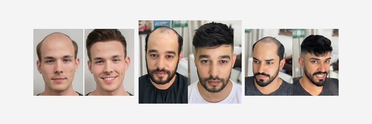 service de pelo