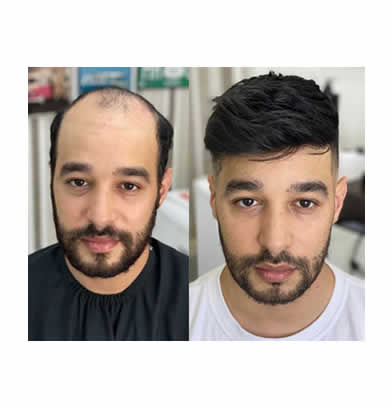 service de pelo